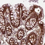 Atlas Antibodies Anti-MARCKS Antibody