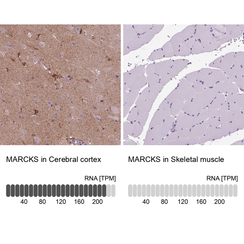 Atlas Antibodies Anti-MARCKS Antibody
