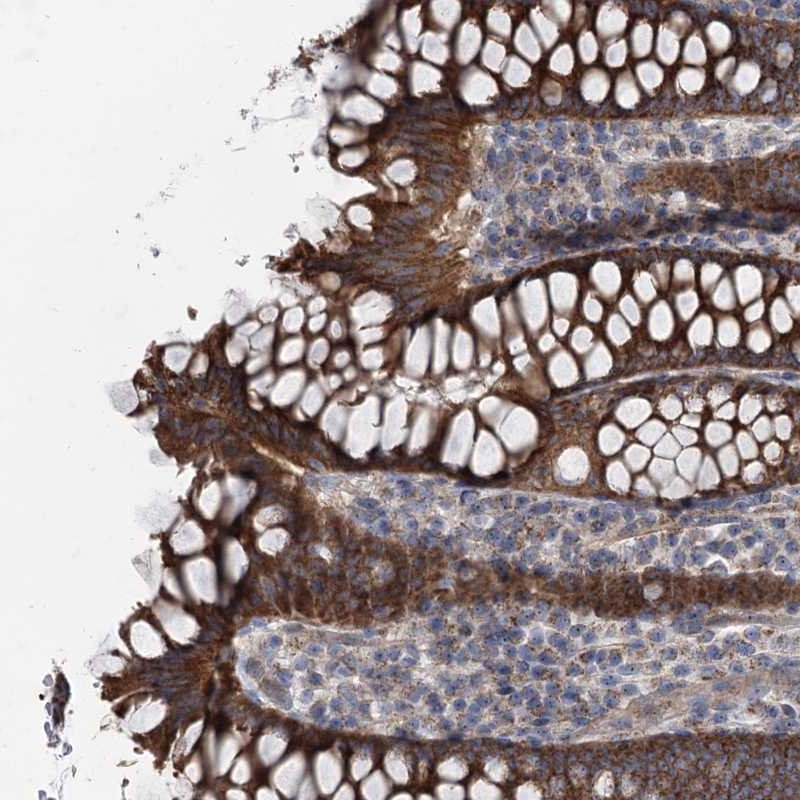 Atlas Antibodies Anti-MARK2 Antibody
