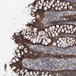 Atlas Antibodies Anti-MARK2 Antibody