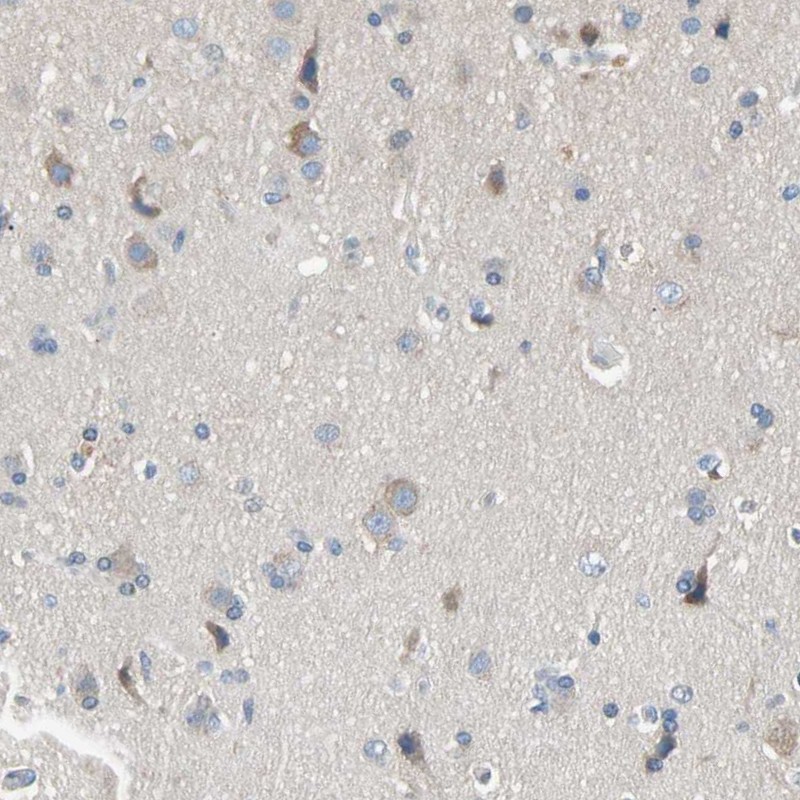 Atlas Antibodies Anti-MARK1 Antibody