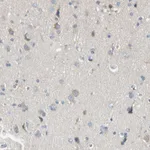 Atlas Antibodies Anti-MARK1 Antibody