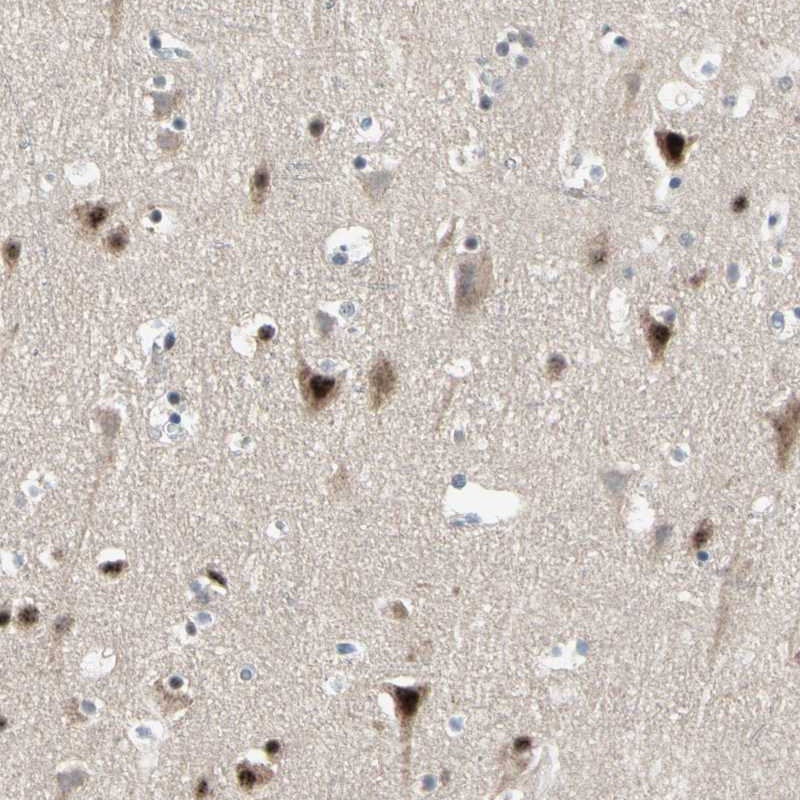 Atlas Antibodies Anti-MARK1 Antibody