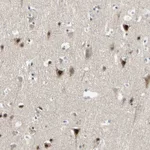 Atlas Antibodies Anti-MARK1 Antibody