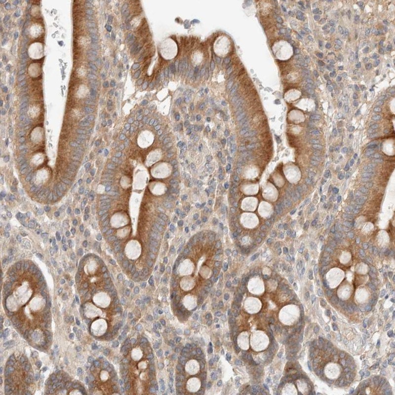 Atlas Antibodies Anti-MARK3 Antibody