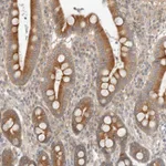Atlas Antibodies Anti-MARK3 Antibody