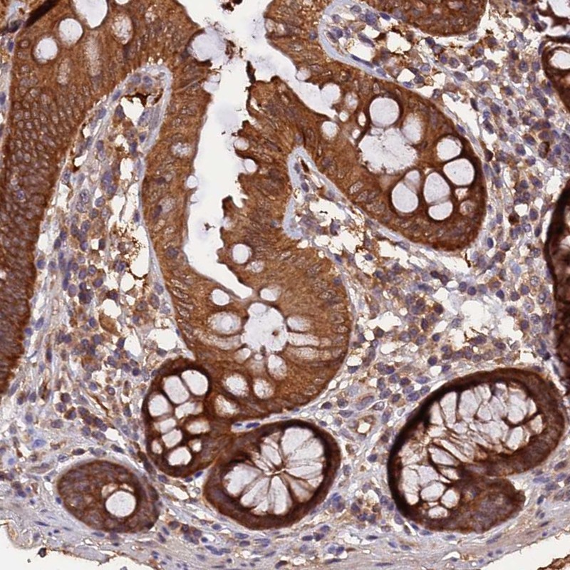 Atlas Antibodies Anti-MARK4 Antibody