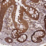 Atlas Antibodies Anti-MARK4 Antibody