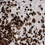 Atlas Antibodies Anti-MARS2 Antibody