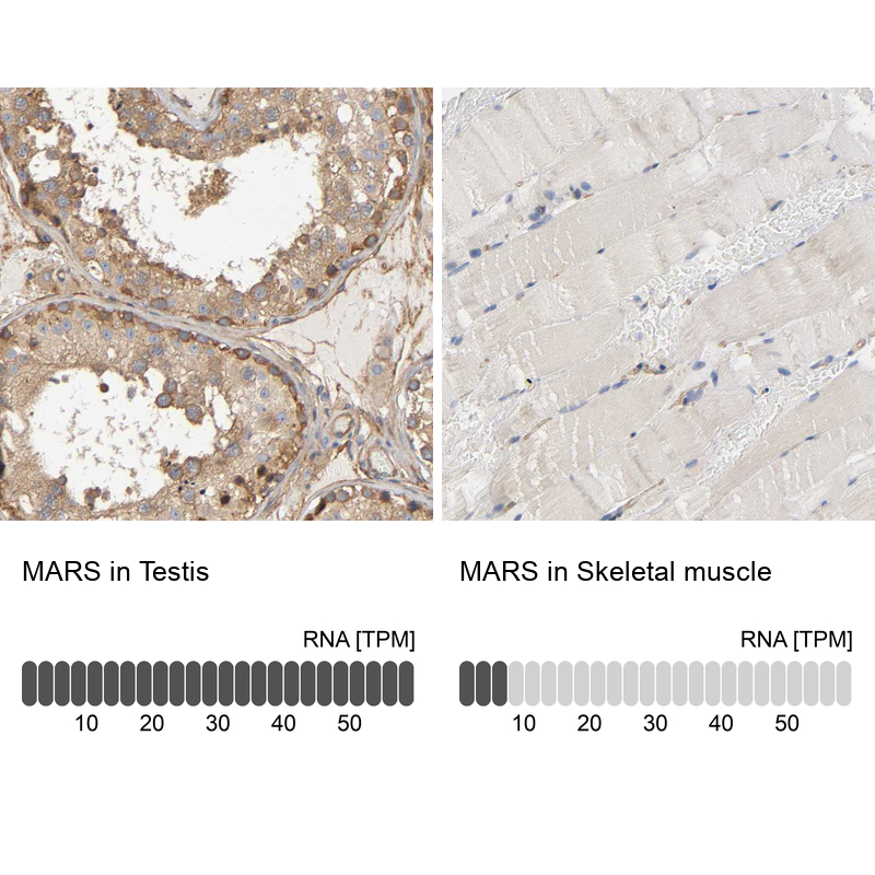 Atlas Antibodies Anti-MARS Antibody