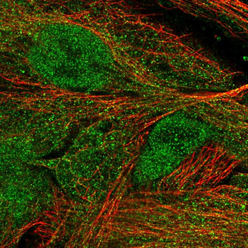 Atlas Antibodies Anti-MASP1 Antibody