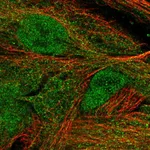 Atlas Antibodies Anti-MASP1 Antibody