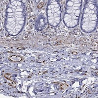 Atlas Antibodies Anti-MAS1 Antibody