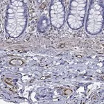 Atlas Antibodies Anti-MAS1 Antibody
