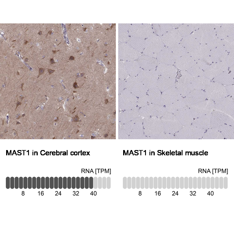 Atlas Antibodies Anti-MAST1 Antibody