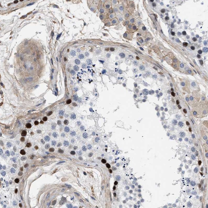 Atlas Antibodies Anti-MAS1L Antibody