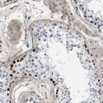 Atlas Antibodies Anti-MAS1L Antibody