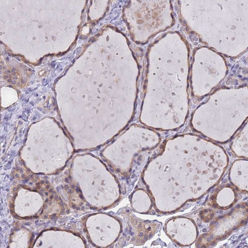 Atlas Antibodies Anti-MARVELD2 Antibody