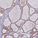 Atlas Antibodies Anti-MARVELD2 Antibody