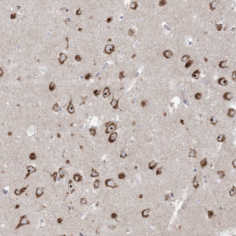 Atlas Antibodies Anti-MARS2 Antibody