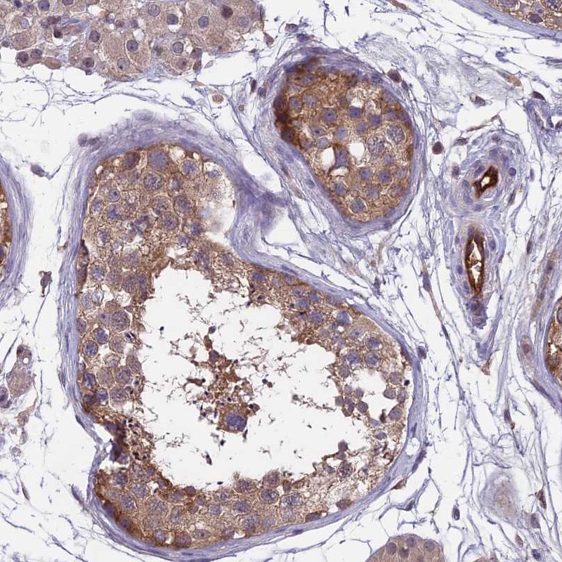 Atlas Antibodies Anti-MAST2 Antibody