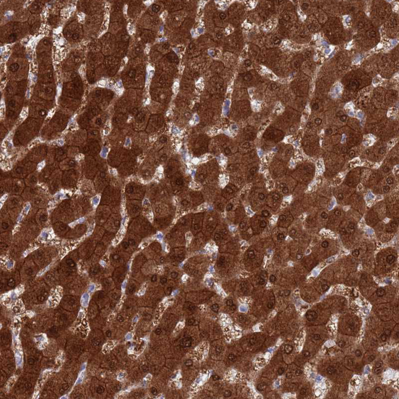 Atlas Antibodies Anti-MAT1A Antibody