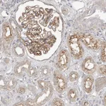 Atlas Antibodies Anti-MAT2B Antibody