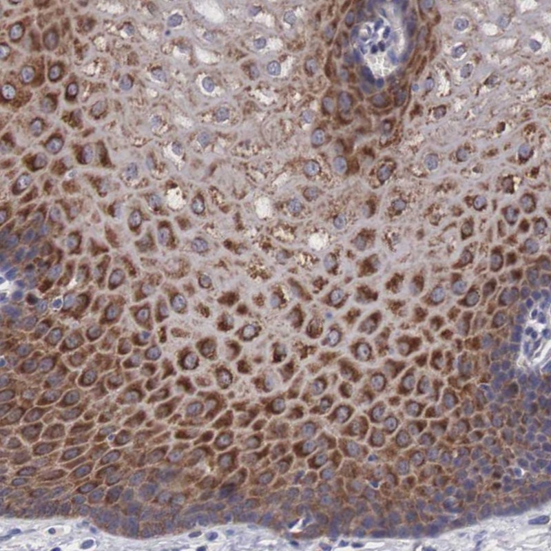 Atlas Antibodies Anti-MAST4 Antibody