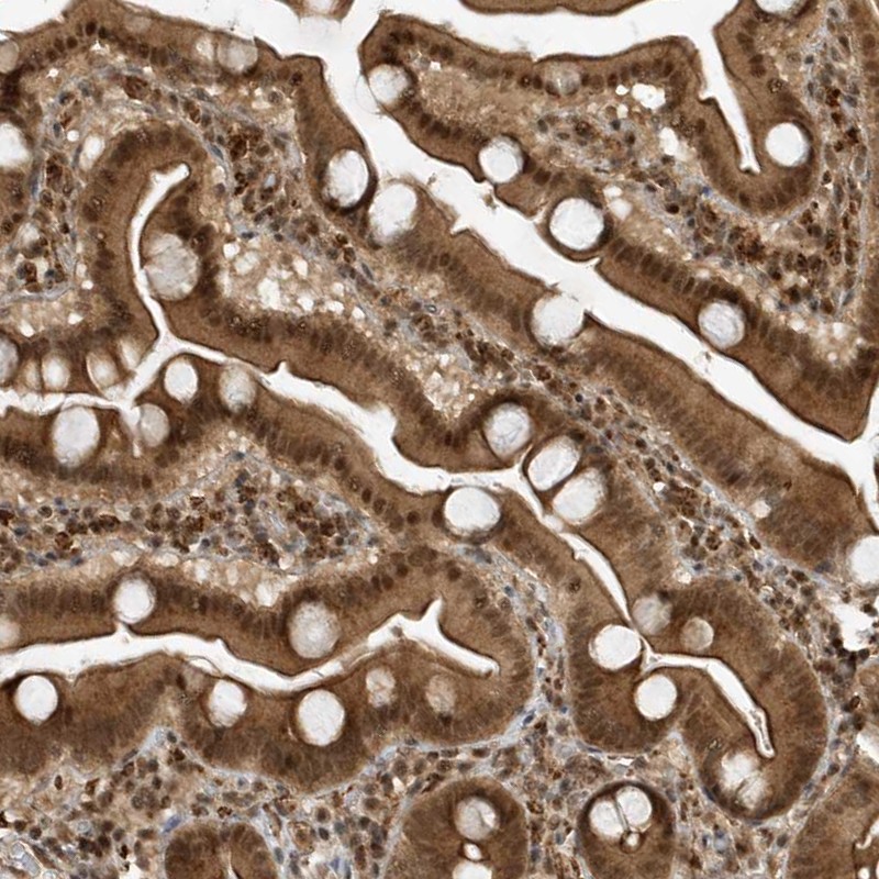 Atlas Antibodies Anti-MAST3 Antibody
