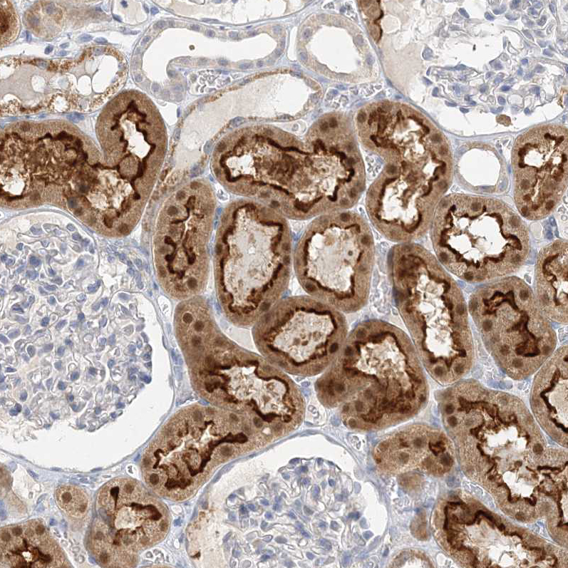 Atlas Antibodies Anti-MAT2B Antibody