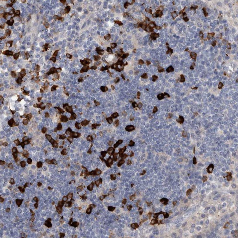 Atlas Antibodies Anti-MASTL Antibody