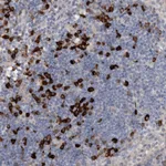 Atlas Antibodies Anti-MASTL Antibody