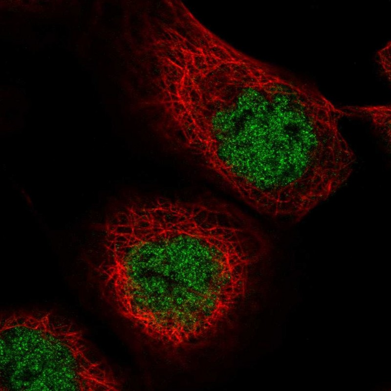 Atlas Antibodies Anti-MASTL Antibody
