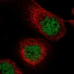Atlas Antibodies Anti-MASTL Antibody