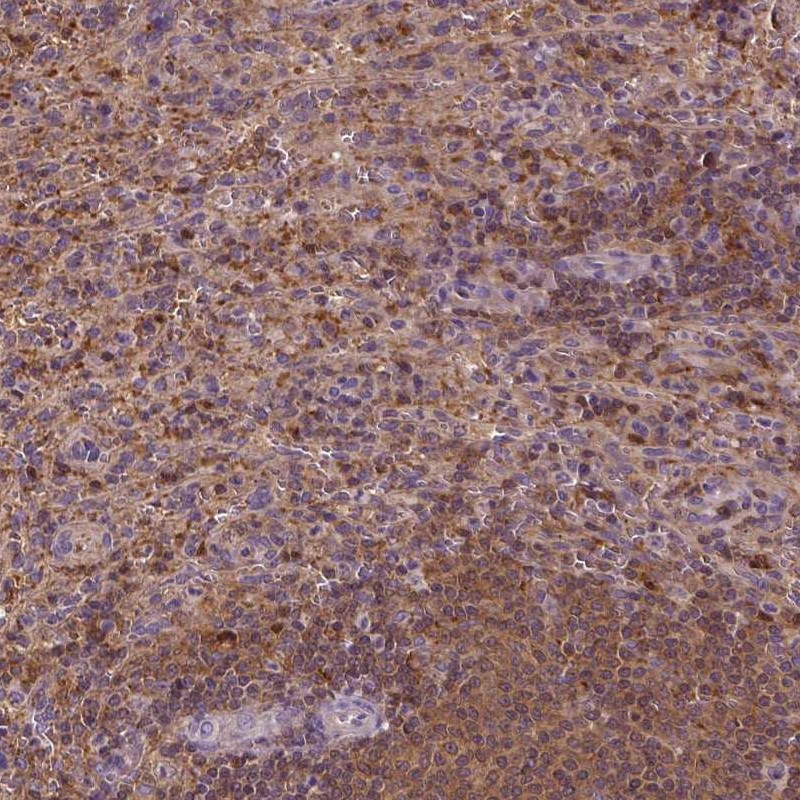 Atlas Antibodies Anti-MATK Antibody
