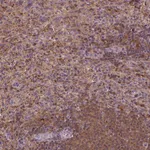 Atlas Antibodies Anti-MATK Antibody