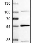 Atlas Antibodies Anti-MATK Antibody