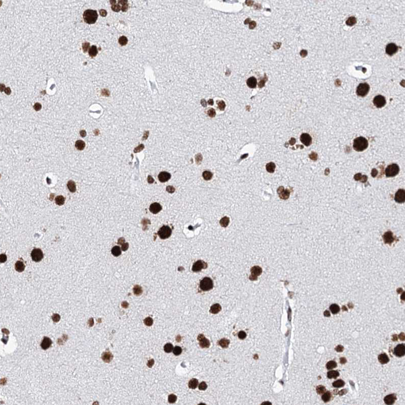 Atlas Antibodies Anti-MATR3 Antibody