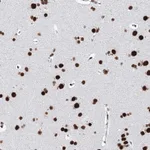 Atlas Antibodies Anti-MATR3 Antibody
