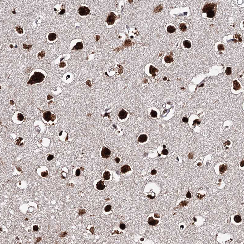 Atlas Antibodies Anti-MATR3 Antibody