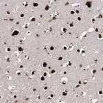 Atlas Antibodies Anti-MATR3 Antibody