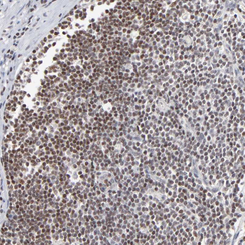 Atlas Antibodies Anti-MAX Antibody