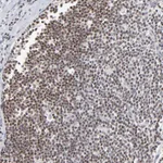 Atlas Antibodies Anti-MAX Antibody