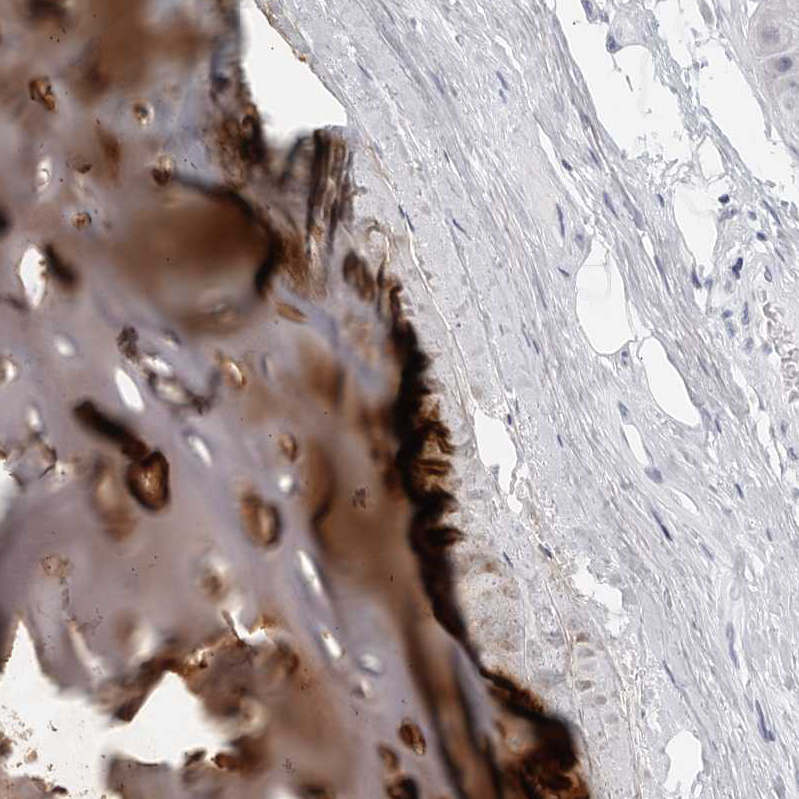 Atlas Antibodies Anti-MATN1 Antibody