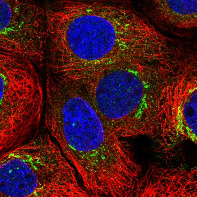 Atlas Antibodies Anti-MATN3 Antibody