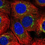 Atlas Antibodies Anti-MATN3 Antibody