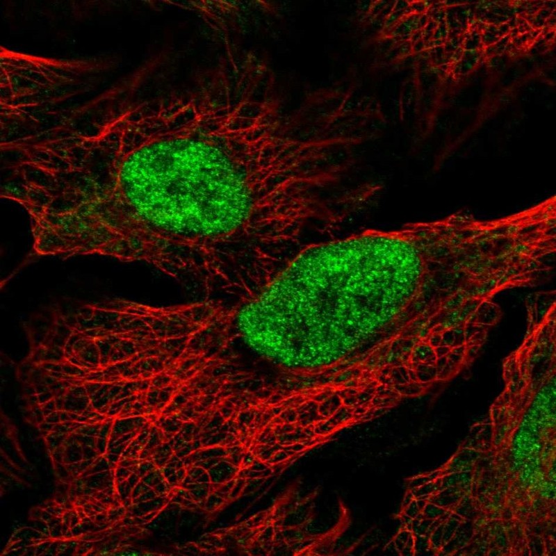 Atlas Antibodies Anti-MAU2 Antibody