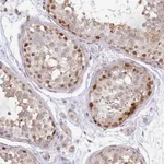 Atlas Antibodies Anti-MAZ Antibody